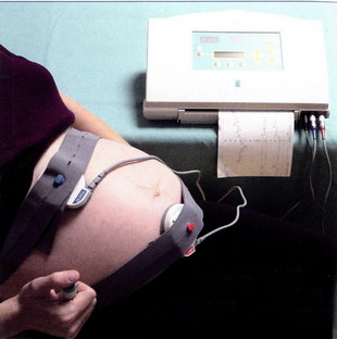 Surveillance de grossesse pathologique à domicile – Corinne Roques